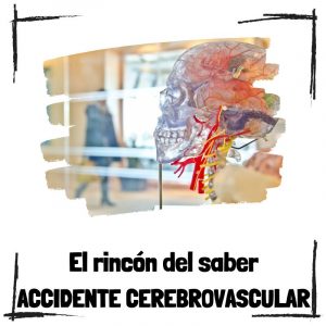 Accidente cerebrovascular: Todo lo que debes saber